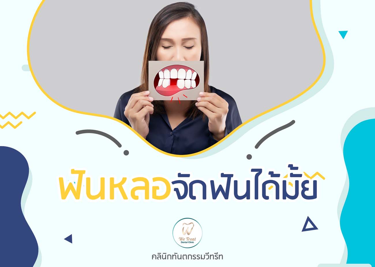 05 ฟันหลอจัดฟันได้มั้ย