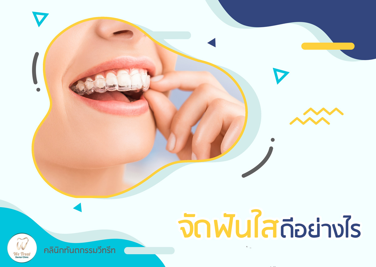 10 จัดฟันใสดีอย่างไร