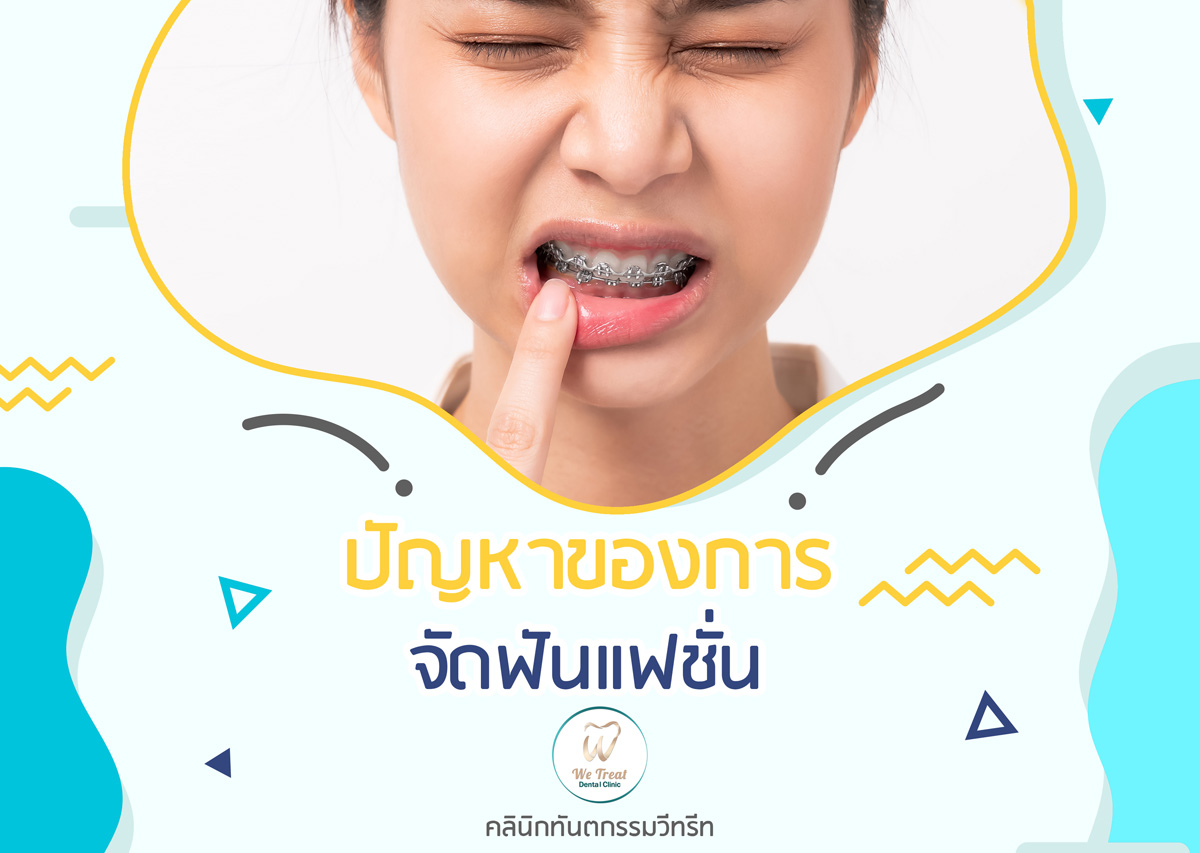 11 ปัญหาของการจัดฟันแฟชั่น