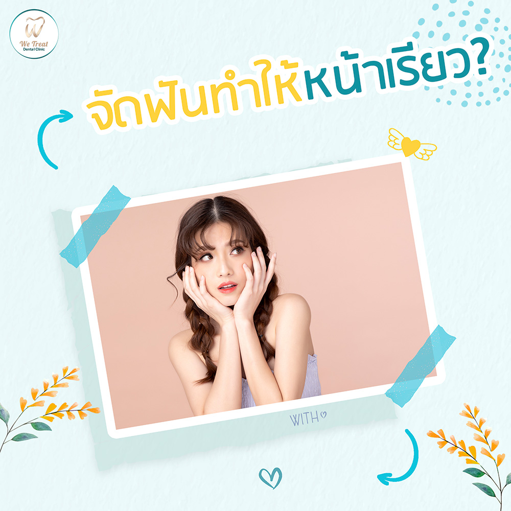 21-จัดฟันทำให้หน้าเรียว