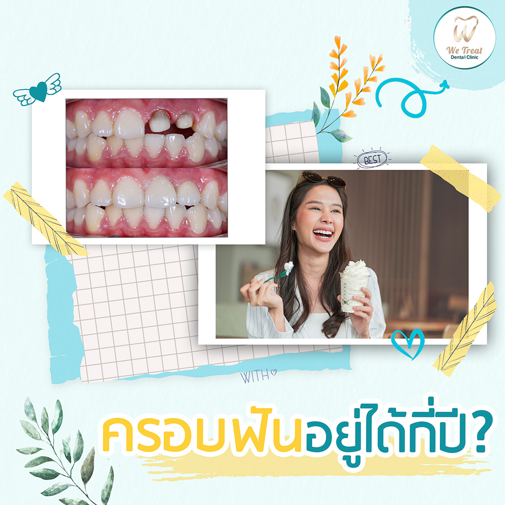 23-T2-ครอบฟันอยู่ำด้กราปี