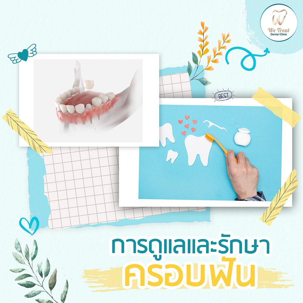 28-T2-การดูแลครอบฟัน