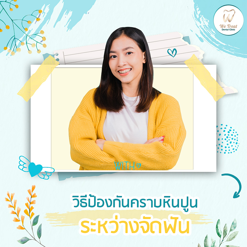 32-T3-รักษารากครอบฟัน-จะจัดฟัน