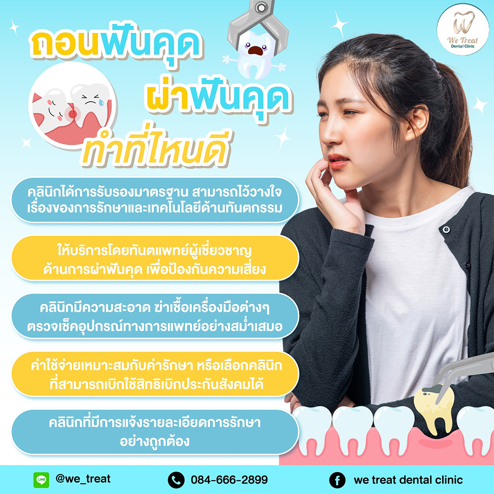 ถอนฟันคุด ผ่าฟันคุด ทำที่ไหนดี? - We Treat Dental Clinic คลินิกทันตกรรม ...
