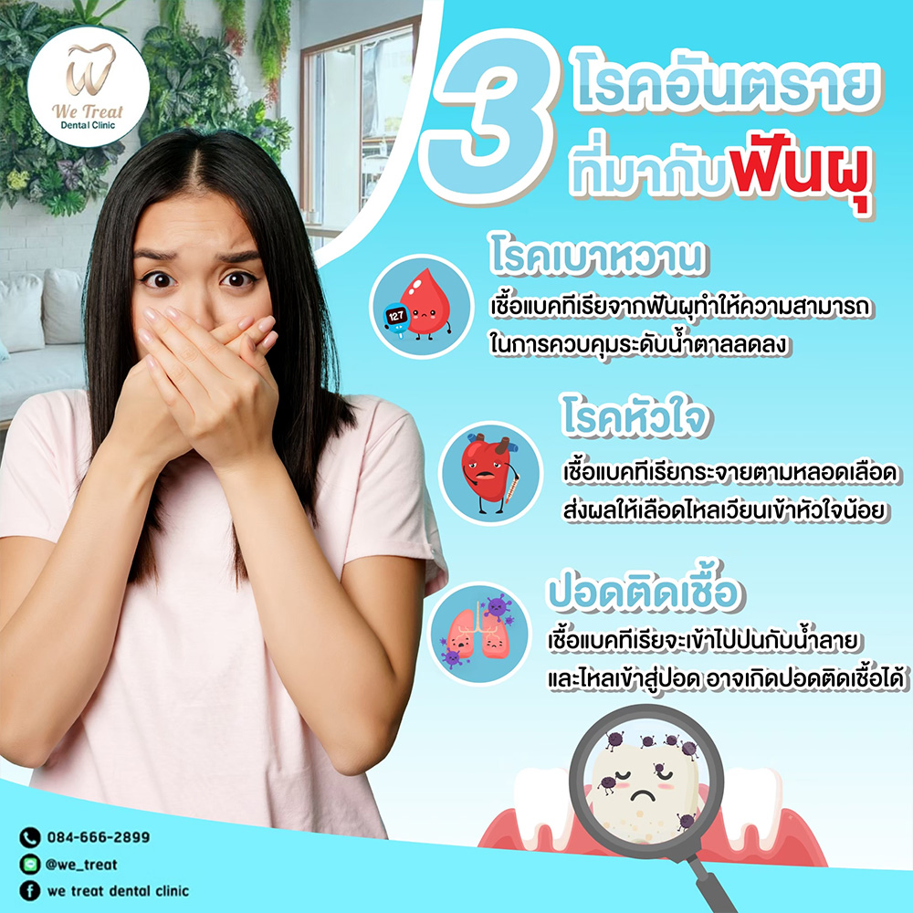 3-สัญญาณ-โรคฟันพุ-สาระน่ารู้