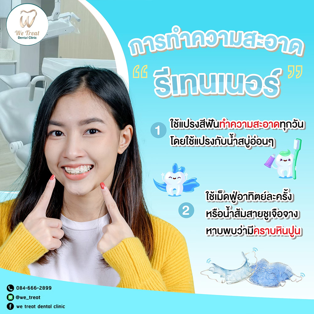 การทำความสะอาด-รีเทนเนอร์–สาระน่ารู้