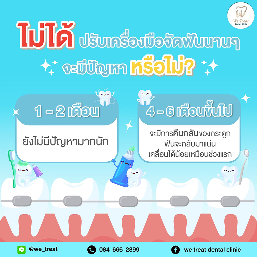 ไม่ปรับเครื่องจัดฟันนาน-สาระน่ารู้