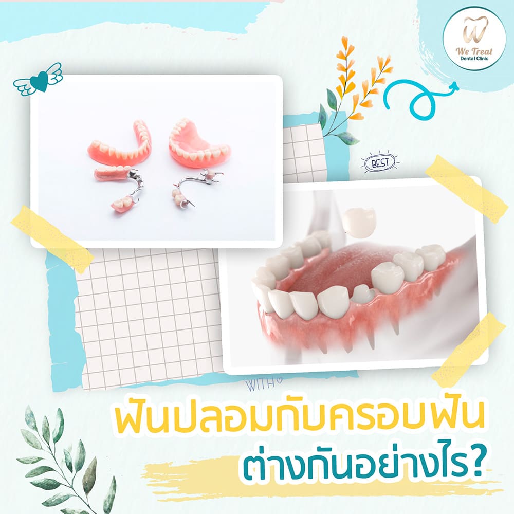 ฟันปลอมกับครอบฟันต่างกันอย่างไร-สาระน่ารู้