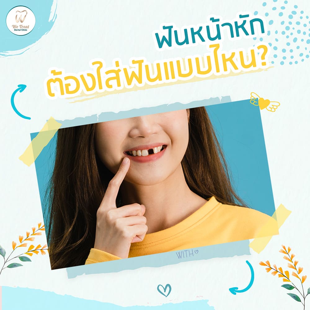 ฟันหน้าหักยิ้มไม่มั่นใจ-ใส่ฟันปลอมแบบไหนดี-สาระน่ารู้