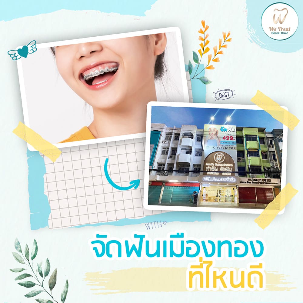 จัดฟันเมืองทองธานีทำที่ไหนดี-สาระ