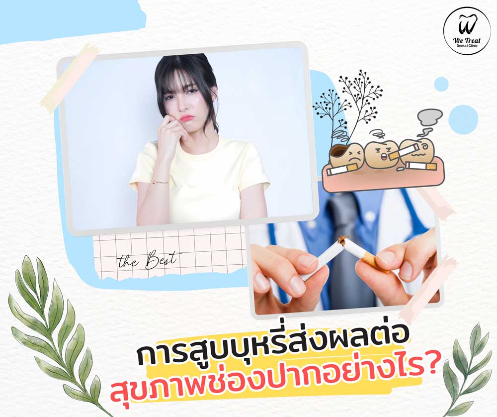 the Best – 24