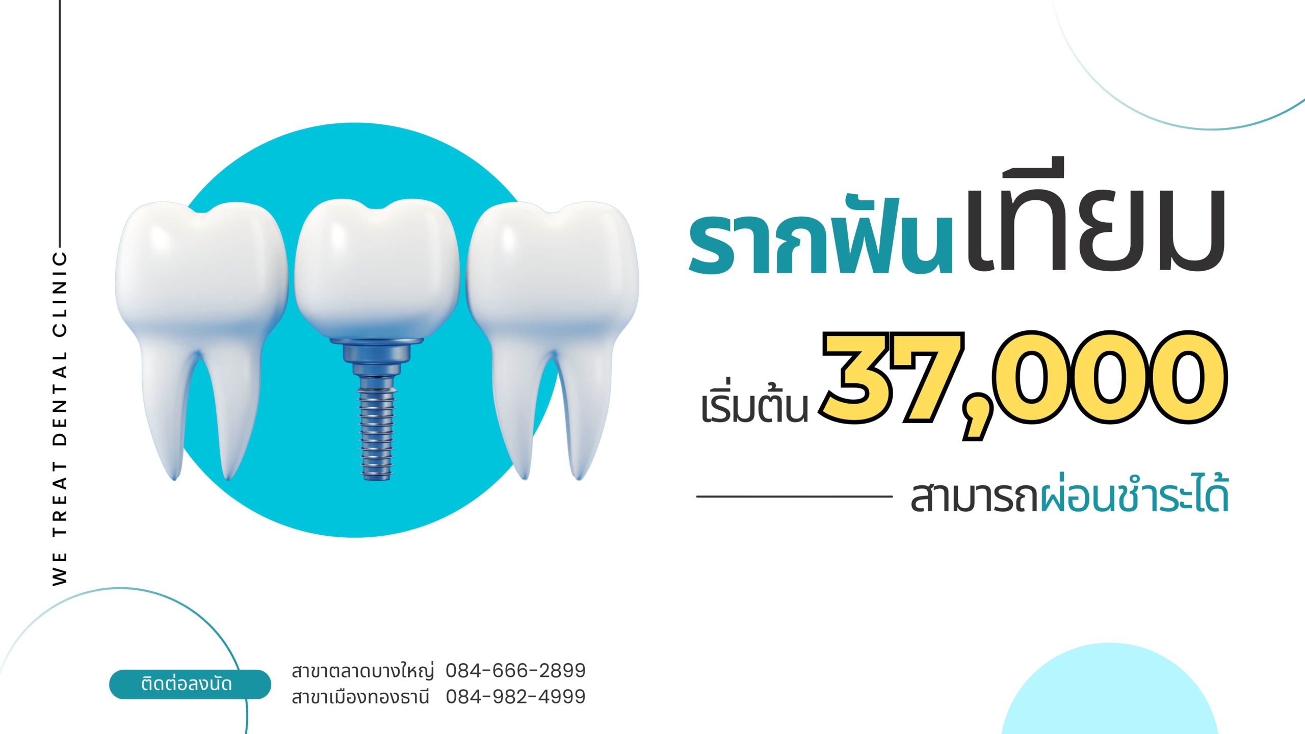 ปักรากเทียม เริ่มต้น 37,000.-